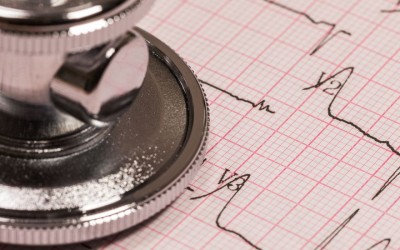 New algorithm to predict risk of heart disease deaths in women.